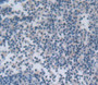 Used in DAB staining on fromalin fixed paraffin- embedded lymph node tissue