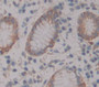 Fibroblast Growth Factor Receptor 4 (Fgfr4) Polyclonal Antibody, Cat#CAU25286
