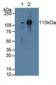 Western Blot; Sample: Lane1: Rat Serum; Lane2: Mouse Lung Tissue.