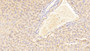 DAB staining on IHC-P; Samples: Mouse Liver Tissue;  Primary Ab: 20μg/ml Rabbit Anti-Mouse SAA2 Antibody Second Ab: 2µg/mL HRP-Linked Caprine Anti-Rabbit IgG Polyclonal Antibody 
