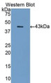 Western Blot; Sample: Recombinant protein.