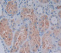 Used in DAB staining on fromalin fixed paraffin- embedded Kidney tissue