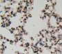 Used in DAB staining on fromalin fixed paraffin- embedded Kidney tissue