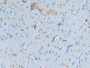 DAB staining on IHC-P; Samples: Rat Heart Tissue; Primary Ab: 20µg/ml Rabbit Anti-Rat S100A6 Antibody Second Ab: 2µg/mL HRP-Linked Caprine Anti-Rabbit IgG Polyclonal Antibody