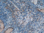 DAB staining on fromalin fixed paraffin-embedded lung tissue)