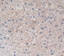 Used in DAB staining on fromalin fixed paraffin- embedded Kidney tissue