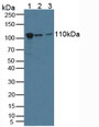 Western Blot; Sample: Lane1: Human A549 Cells; Lane2: Human Hela Cells; Lane3: Human Lung Tissue.