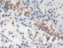 DAB staining on IHC-P; Samples: Human Lung Tissue; Primary Ab: 10µg/ml Rabbit Anti-Human MVP Antibody Second Ab: 2µg/mL HRP-Linked Caprine Anti-Rabbit IgG Polyclonal Antibody