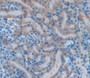 Inhibin Beta B (Inhbb) Polyclonal Antibody, Cat#CAU25354