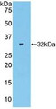 Western Blot; Sample: Recombinant OSMR, Human.