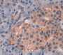 Regenerating Islet Derived Protein 1 Alpha (Reg1A) Polyclonal Antibody, Cat#CAU25363