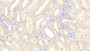 DAB staining on IHC-P; Samples: Human Kidney Tissue; Primary Ab: 30µg/ml Rabbit Anti-Human MHCE Antibody Second Ab: 2µg/mL HRP-Linked Caprine Anti-Rabbit IgG Polyclonal Antibody