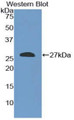 Western Blot; Sample: Recombinant protein.