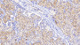 DAB staining on IHC-P; Samples: Human Kidney Tissue; Primary Ab: 20μg/ml Rabbit Anti-Simian TNFSF13 Antibody Second Ab: 2µg/mL HRP-Linked Caprine Anti-Rabbit IgG Polyclonal Antibody
