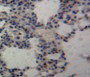 Used in DAB staining on fromalin fixed paraffin-embedded lung tissue