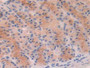 DAB staining on IHC-P; Samples: Rat Stomach Tissue; Primary Ab: 20µg/ml Rabbit Anti-Rat PFKP Antibody Second Ab: 2µg/mL HRP-Linked Caprine Anti-Rabbit IgG Polyclonal Antibody
