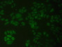 FITC staining on IHC-P; Samples: Human Hela Cells