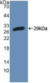 Western Blot; Sample: Recombinant PFKP, Mouse.