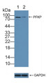 Knockout Varification: ; Lane 1: Wild-type A549 cell lysate; ; Lane 2: PFKP knockout A549 cell lysate; ; Predicted MW: 85kd ; Observed MW: 85kd; Primary Ab: 3µg/ml Rabbit Anti-Human PFKP Antibody; Second Ab: 0.2µg/mL HRP-Linked Caprine Anti-Rabbit IgG Polyclonal Antibody;