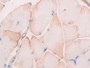 DAB staining on IHC-P; Samples: Rat Skeletal muscle Tissue; Primary Ab: 10µg/ml Rabbit Anti-Rat UBD Antibody Second Ab: 2µg/mL HRP-Linked Caprine Anti-Rabbit IgG Polyclonal Antibody