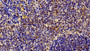 DAB staining on IHC-P; Samples: Rat Spleen Tissue; Primary Ab: 10μg/ml Rabbit Anti-Rat STAT6 Antibody Second Ab: 2µg/mL HRP-Linked Caprine Anti-Rabbit IgG Polyclonal Antibody