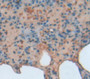 B-Cell Cll/Lymphoma 3 (Bcl3) Polyclonal Antibody, Cat#CAU25415