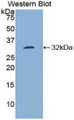 Western Blot; Sample: Recombinant protein.