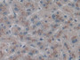 DAB staining on IHC-P; Samples: Human Liver Tissue