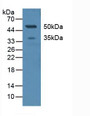 Western Blot; Sample: Human Serum.