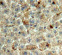 Used in DAB staining on fromalin fixed paraffin-embedded Liver tissue