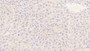 DAB staining on IHC-P; Samples: Mouse Liver Tissue; Primary Ab: 20μg/ml Rabbit Anti-Mouse CD163 Antibody Second Ab: 2µg/mL HRP-Linked Caprine Anti-Rabbit IgG Polyclonal Antibody