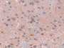 DAB staining on IHC-P; Samples: Rat Spinal cord Tissue; Primary Ab: 10µg/ml Rabbit Anti-Rat PDXK Antibody Second Ab: 2µg/mL HRP-Linked Caprine Anti-Rabbit IgG Polyclonal Antibody