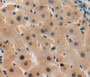 DAB staining on fromalin fixed paraffin-embedded liver tissue)
