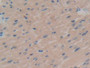 DAB staining on IHC-P; Samples: Mouse Heart Tissue; Primary Ab: 10µg/ml Rabbit Anti-Mouse SGK1 Antibody Second Ab: 2µg/mL HRP-Linked Caprine Anti-Rabbit IgG Polyclonal Antibody