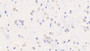 DAB staining on IHC-P; Samples: Rat Cerebrum Tissue;  Primary Ab: 10μg/ml Rabbit Anti-Rat MyD88 Antibody Second Ab: 2µg/mL HRP-Linked Caprine Anti-Rabbit IgG Polyclonal Antibody 