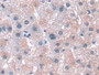 DABstainingonIHC-P.Samples:HumanTissue)