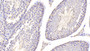 DAB staining on fromalin fixed paraffin-embedded Kidney tissue)