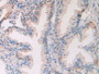 Figure. DAB staining on IHC-P; Samples: Human Prostate Gland Tissue.