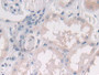 DAB staining on IHC-P; Samples: Human Kidney Tissue; Primary Ab: 30µg/ml Rabbit Anti-Human IL25 Antibody Second Ab: 2µg/mL HRP-Linked Caprine Anti-Rabbit IgG Polyclonal Antibody