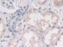 DAB staining on IHC-P; Samples: Human Kidney Tissue)