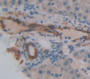 Cytokeratin 10 (Ck10) Polyclonal Antibody, Cat#CAU25487