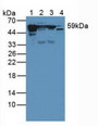 Western Blot; Sample: Lane1: Rat Skin Tissue; Lane2: Rat Brain Tissue; Lane3: Mouse Brain Tissue; Lane4: Mouse Skin Tissue.