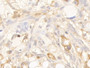 DAB staining on IHC-P. Samples: Human Tissue)