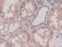 DAB staining on IHC-P; Samples: Human Kidney Tissue; Primary Ab: 30µg/ml Rabbit Anti-Human IL28A Antibody Second Ab: 2µg/mL HRP-Linked Caprine Anti-Rabbit IgG Polyclonal Antibody