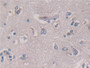 DAB staining on fromalin fixed paraffin-embedded Pancreas tissue)