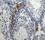 Used in DAB staining on fromalin fixed paraffin-embedded Testis tissue