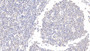 DAB staining on IHC-P; Samples: Human Tonsil Tissue;  Primary Ab: 20µg/ml Rabbit Anti-Human IL21 Antibody Second Ab: 2µg/mL HRP-Linked Caprine Anti-Rabbit IgG Polyclonal Antibody 
