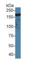 Western Blot; Sample: Human Jurkat cell lysate; Primary Ab: 1.5µg/ml Rabbit Anti-Rat ITGaM Antibody Second Ab: 0.2µg/mL HRP-Linked Caprine Anti-Rabbit IgG Polyclonal Antibody