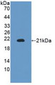 Western Blot; Sample: Recombinant ITGaM, Mouse.