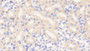 DAB staining on IHC-P; Samples: Mouse Kidney Tissue; Primary Ab: 20μg/ml Rabbit Anti-Mouse SOCS3 Antibody Second Ab: 2µg/mL HRP-Linked Caprine Anti-Rabbit IgG Polyclonal Antibody